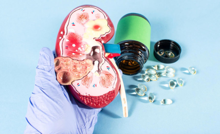 Best Natural Ways to Support Kidney Health After Drug Use