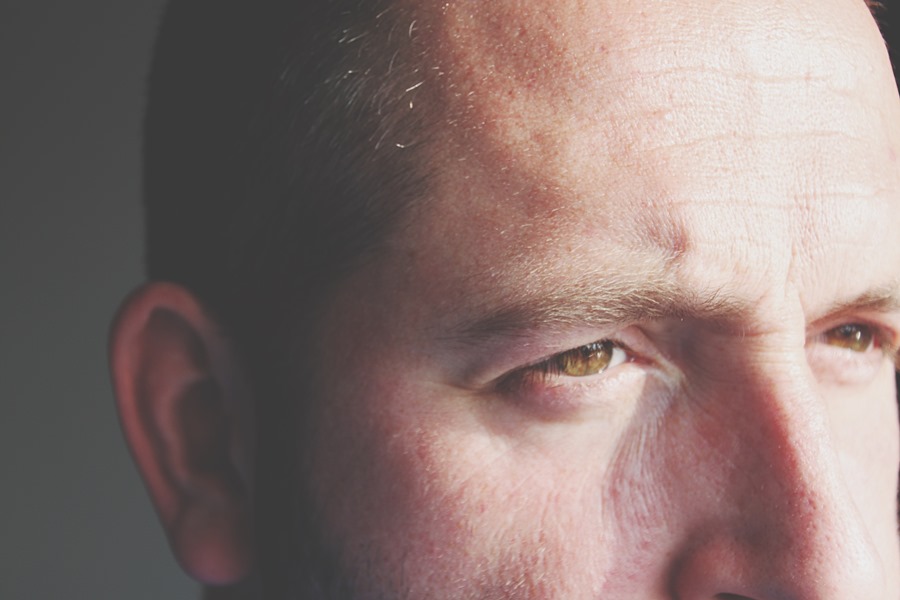 Opioid Eyes: Pinpoint Pupils and Other Symptoms of Use